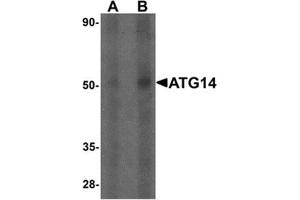 Western blot analysis of ATG14 in human small intestine tissue lysate with ATG14 Antibody  at (A) 1 and (B) 2 µg/mL. (ATG14 antibody  (Middle Region))