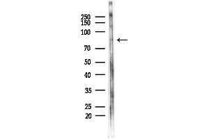 Western blot analysis of lysates from PC12 cells(starvation 24h treatment), using Photomedin-2 Antibody at 1/1000 dilution.