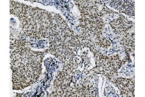 IHC analysis of Transketolase/TKT using anti-Transketolase/TKT antibody (ABIN7598957). (TKT antibody  (AA 1-116))