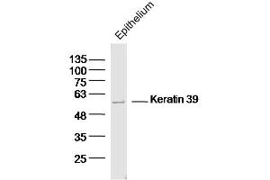 Mouse epithelium lysates probed with Keratin 39 Polyclonal Antibody, Unconjugated  at 1:300 dilution and 4˚C overnight incubation. (Keratin 39 (KRT39) (AA 401-491) antibody)