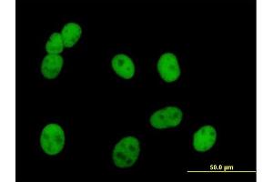 Immunofluorescence of purified MaxPab antibody to PMS2 on HeLa cell.