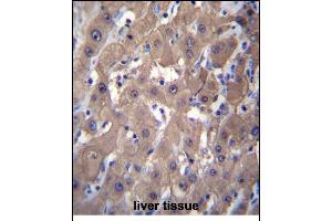 AKR1C2 Antibody (C-term) (ABIN656180 and ABIN2845509) immunohistochemistry analysis in formalin fixed and paraffin embedded human liver tissue followed by peroxidase conjugation of the secondary antibody and DAB staining. (AKR1C2 antibody  (C-Term))