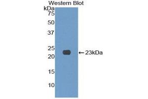 Western Blotting (WB) image for anti-Killer Cell Lectin-Like Receptor Subfamily C, Member 2 (KLRC2) (AA 19-190) antibody (ABIN1859564) (KLRC2 antibody  (AA 19-190))