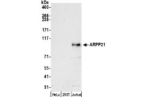 Western Blotting (WB) image for anti-cAMP-Regulated phosphoprotein, 21kDa (ARPP21) (AA 1-50) antibody (ABIN7449210)
