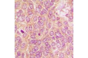 Immunohistochemistry (IHC) image for anti-Eukaryotic Translation Initiation Factor 2-alpha Kinase 2 (EIF2AK2) (C-Term) antibody (ABIN7301606)