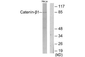 Western Blotting (WB) image for anti-Catenin (Cadherin-Associated Protein), beta 1, 88kDa (CTNNB1) (C-Term) antibody (ABIN1849332) (CTNNB1 antibody  (C-Term))