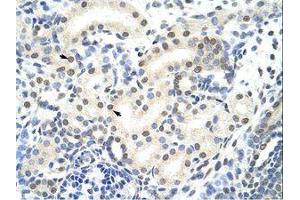 Image no. 1 for anti-Small Nuclear Ribonucleoprotein 70kDa (U1) (SNRNP70) (AA 21-70) antibody (ABIN203140) (SNRNP70 antibody  (AA 21-70))