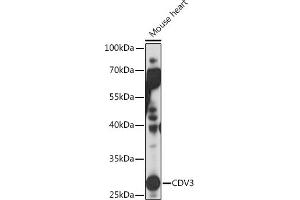 Western blot analysis of extracts of Mouse heart, using CDV3 Rabbit pAb (ABIN7266240) at 1:1000 dilution. (CDV3 antibody)