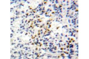Used in DAB staining on fromalin fixed paraffin-embedded Spleen tissue (CXCL1 antibody  (AA 35-107))