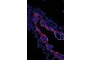 Immunohistochemical staining of extraembryonic membranes from stage 16 chick embryos using  TGFβIII receptor antibody. (TGFBR3 antibody  (Extracellular Domain))