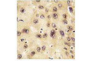 Immunohistochemistry (IHC) image for anti-Prospero Homeobox 1 (PROX1) (AA 185-214) antibody (ABIN3032343)