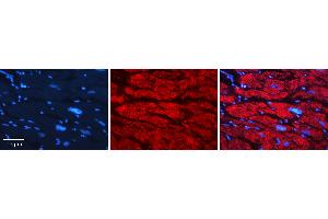 Rabbit Anti-GNS Antibody   Formalin Fixed Paraffin Embedded Tissue: Human heart Tissue Observed Staining: Cytoplasmic Primary Antibody Concentration: 1:100 Other Working Concentrations: N/A Secondary Antibody: Donkey anti-Rabbit-Cy3 Secondary Antibody Concentration: 1:200 Magnification: 20X Exposure Time: 0. (GNS antibody  (C-Term))