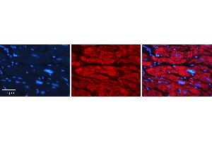 Rabbit Anti-GNS Antibody   Formalin Fixed Paraffin Embedded Tissue: Human heart Tissue Observed Staining: Cytoplasmic Primary Antibody Concentration: 1:100 Other Working Concentrations: N/A Secondary Antibody: Donkey anti-Rabbit-Cy3 Secondary Antibody Concentration: 1:200 Magnification: 20X Exposure Time: 0. (GNS antibody  (C-Term))
