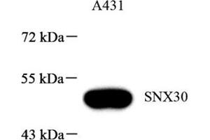 Western blot analysis of SNX30 (ABIN7075693),at dilution of 1: 1000 (SNX30 antibody)