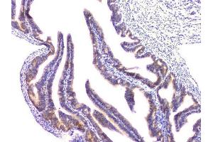 IHC analysis of RAB11B using anti-RAB11B antibody (ABIN6719364). (RAB11B antibody)