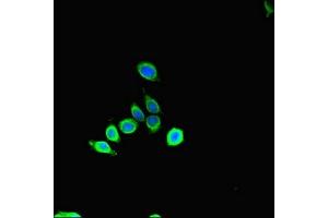 Immunofluorescent analysis of HepG2 cells using ABIN7160637 at dilution of 1:100 and Alexa Fluor 488-congugated AffiniPure Goat Anti-Rabbit IgG(H+L) (SET Binding Factor 2 antibody  (AA 1585-1813))