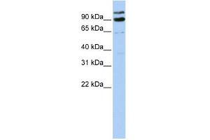 LONRF3 antibody used at 1 ug/ml to detect target protein. (LONRF3 antibody  (Middle Region))