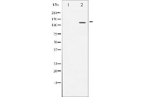 Western blot analysis of NFAT4 expression in HeLa whole cell lysates,The lane on the left is treated with the antigen-specific peptide. (NFATC3 antibody  (N-Term))