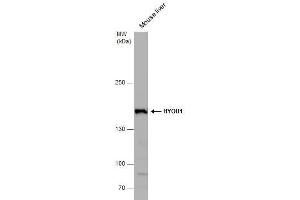 Western Blotting (WB) image for anti-Hypoxia Up Regulated 1 (HYOU1) (C-Term) antibody (ABIN2855339)