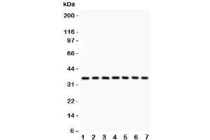 Western blot testing of IkBa antibody and Lane 1:  rat brain;  2: mouse brain;  3: (r) kidney;  4: (m) kidney;  5: human 293T;  6: (h) Jurkat;  7: (h) Raji lysate. (NFKBIA antibody  (AA 3-112))