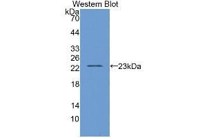 Western blot analysis of the recombinant protein. (D2HGDH antibody  (AA 56-232))