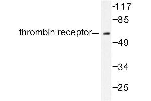 Image no. 1 for anti-Thyroid Hormone Receptor, alpha (THRA) antibody (ABIN271852) (THRA antibody)