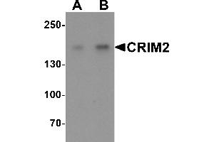 Western blot analysis of CRIM2 in Jurkat cell lysate with CRIM2 antibody at (A) 1 and (B) 2 µg/mL. (KCP antibody  (C-Term))