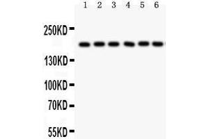 Western Blotting (WB) image for anti-Pregnancy-Associated Plasma Protein A, Pappalysin 1 (PAPPA) (AA 95-388) antibody (ABIN3043377) (PAPPA antibody  (AA 95-388))