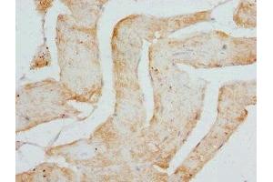 Immunohistochemistry of paraffin-embedded human skeletal muscle tissue using ABIN7149014 at dilution of 1:100 (CSRP3 antibody  (AA 1-194))