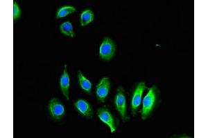 Immunofluorescent analysis of A549 cells using ABIN7148816 at dilution of 1:100 and Alexa Fluor 488-congugated AffiniPure Goat Anti-Rabbit IgG(H+L)