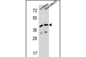 L2HGDH Antibody (Center) (ABIN654213 and ABIN2844053) western blot analysis in MDA-M cell line and mouse kidney tissue lysates (35 μg/lane). (L2HGDH antibody  (AA 132-159))