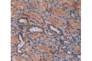 IHC-P analysis of kidney tissue, with DAB staining. (CXCL2 antibody  (AA 34-107))