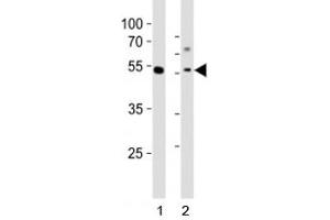 Western blot analysis of lysate from 1) human MCF-7 cell line and 2) mouse liver tissue tissue using Gata6 antibody at 1:1000. (GATA6 antibody  (C-Term))