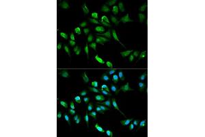 Immunofluorescence analysis of HepG2 cell using ADH5 antibody. (ADH5 antibody  (AA 1-374))