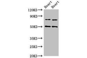 Western Blot Positive WB detected in: Rat heart tissue, Mouse heart tissue All lanes: Acss2 antibody at 4 μg/mL Secondary Goat polyclonal to rabbit IgG at 1/50000 dilution Predicted band size: 79 kDa Observed band size: 79, 50 kDa (ACSS2 antibody  (AA 1-701))