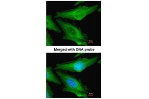 ICC/IF Image Immunofluorescence analysis of paraformaldehyde-fixed HeLa, using TUBB1, antibody at 1:200 dilution. (TUBB1 antibody)