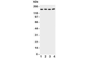 Western blot testing of CPLA2 antibody and Lane 1:  rat testis;  2: (r) brain;  3: human A549;  4: (h) COLO320 cell lysate. (PLA2G4A antibody  (C-Term))