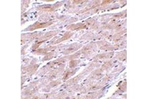 Immunohistochemistry of TRPC3 in mouse heart tissue with this product at 10 μg/ml.
