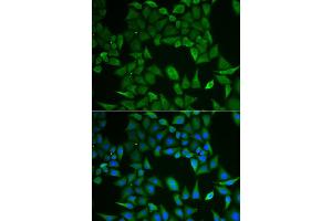 Immunofluorescence analysis of HeLa cell using CLPS antibody. (CLPS antibody)