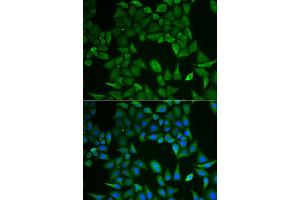 Immunofluorescence analysis of HeLa cell using CLPS antibody.