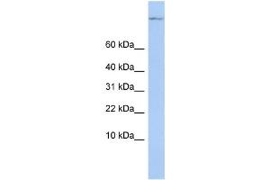 Western Blotting (WB) image for anti-TSC22 Domain Family, Member 1 (TSC22D1) antibody (ABIN2458107)