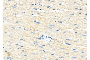 ABIN6260179 and ABIN6279190 at 1/100 staining Rat heart tissue by IHC-P. (B4GALT7 antibody)