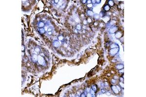 anti-X-Ray Repair Complementing Defective Repair in Chinese Hamster Cells 4 (XRCC4) (AA 1-190) antibody