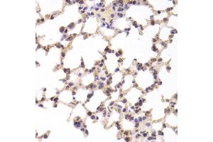 Immunohistochemistry of paraffin-embedded Mouse lung using TSC22D3 antibody at dilution of 1:100 (x400 lens).