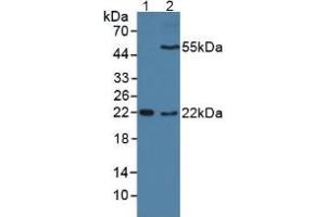 Western blot analysis of (1) Mouse Sp2/0 Cells and (2) Mouse Placenta Tissue. (DC-SIGN/CD209 antibody  (AA 70-404))