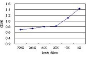 AXL (Human) Matched Antibody Pair