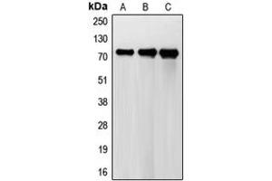 Western blot analysis of FSHR expression in HeLa (A), A431 (B), H1299 (C) whole cell lysates. (FSHR antibody  (Center))