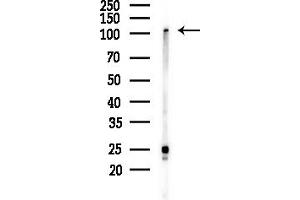 Western blot analysis of lysates from LoVo cells(heat-shock,45 min treatment), using  Antibody at 1/1000 dilution.