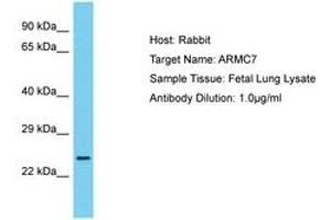 Image no. 1 for anti-Armadillo Repeat Containing 7 (ARMC7) (N-Term) antibody (ABIN6750673) (ARMC7 antibody  (N-Term))