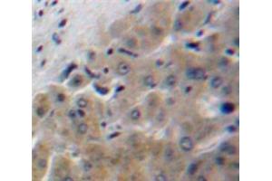 IHC-P analysis of Liver tissue, with DAB staining. (Apolipoprotein F antibody  (AA 122-307))